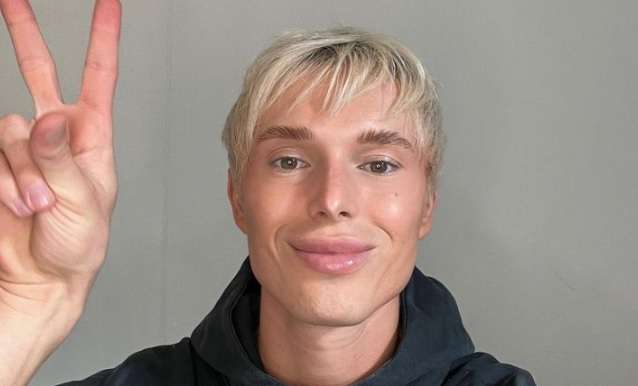 Sergey Hilman paljasti hirveimmän kohtaamansa julkkiksen: "Oli livenä ihan..."